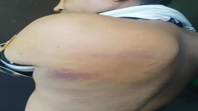 বরগুনায় এক শিক্ষককে ১০ লাখ টাকা মুক্তিপণ দাবিতে অপহরণ ও পাশবিক নির্যাতনের অভিযোগ