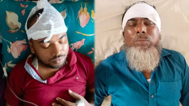 গাছ কাটা নিয়ে রক্তক্ষয়ী সংঘর্ষ: প্রতিপক্ষের হামলায় পিতা-পুত্র গুরুতর জখম, শেবাচিমে ভর্তি