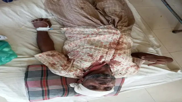 গলাচিপায় জমি সংক্রান্ত বিরোধের জেরে হামলা, আহত ৪