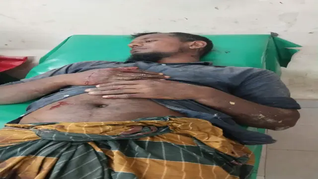গলাচিপায় জমিজমা নিয়ে সংঘর্ষ আহত ৪