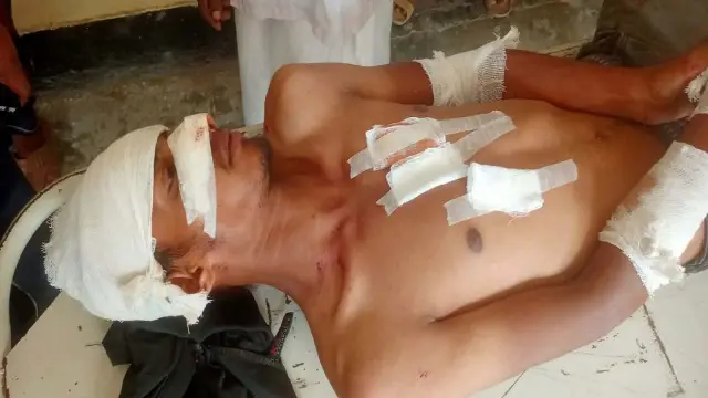 গলাচিপায় অটোরিকশা-মোটরসাইকেলের সংঘর্ষে আহত ৫