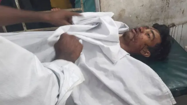 গোপালগঞ্জে মোটর সাইকেল দূর্ঘটনায় যুবক নিহত