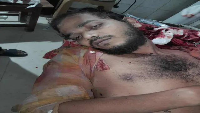 ইন্দুরকানীতে পরকীয়ায় বাধা দেওয়ায় যুবককে কুপিয়ে জখম