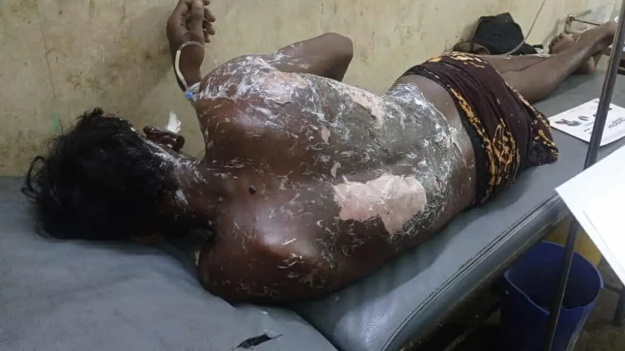 বামনায় বিদ্যুৎস্পৃষ্টে যুবক আহত