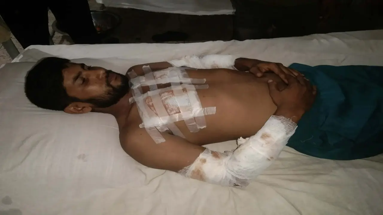 দুমকিতে রাতের আঁধারে গাড়িচালককে কুপিয়ে জখম