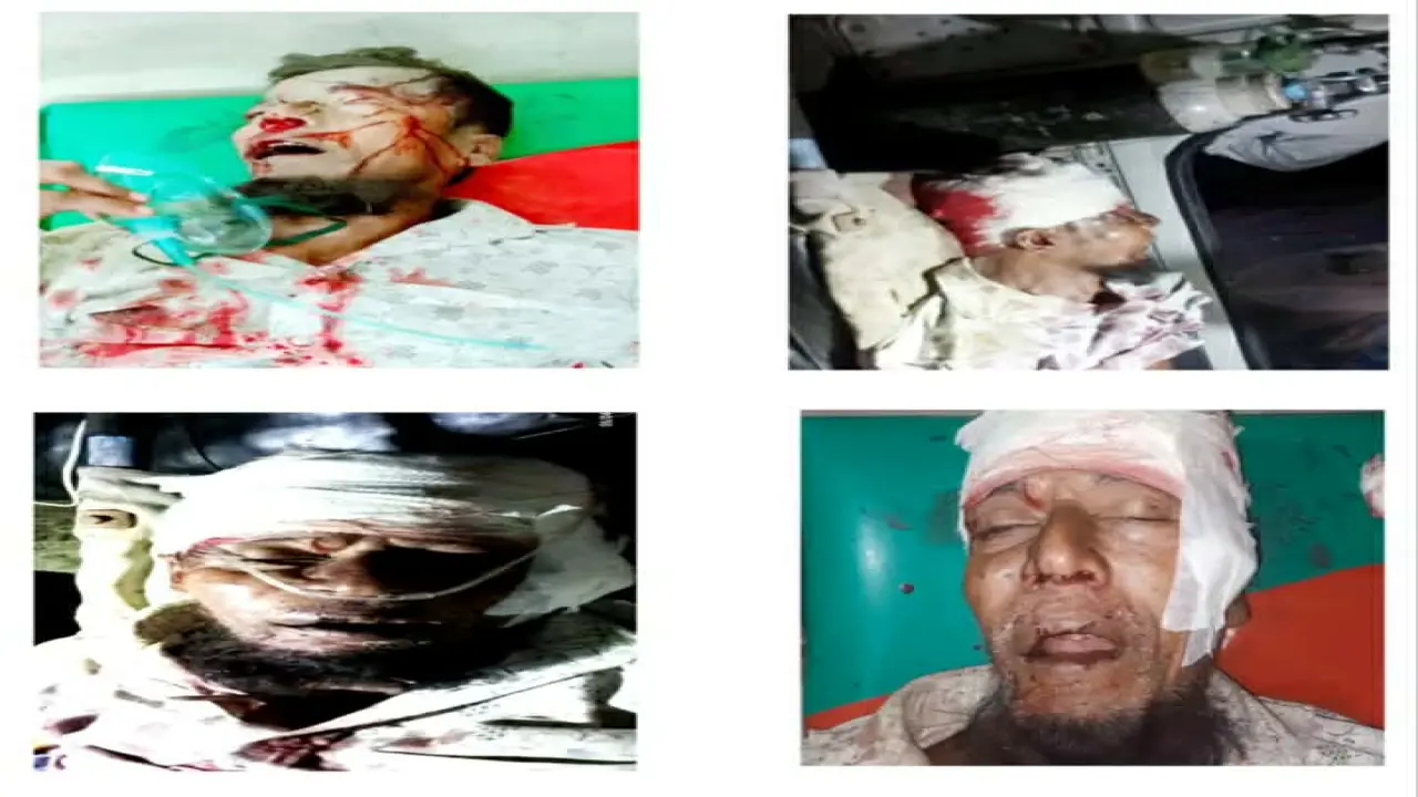 গলাচিপায় জমি-জমা বিরোধের জেরে কৃষক এর উপর হামলা
