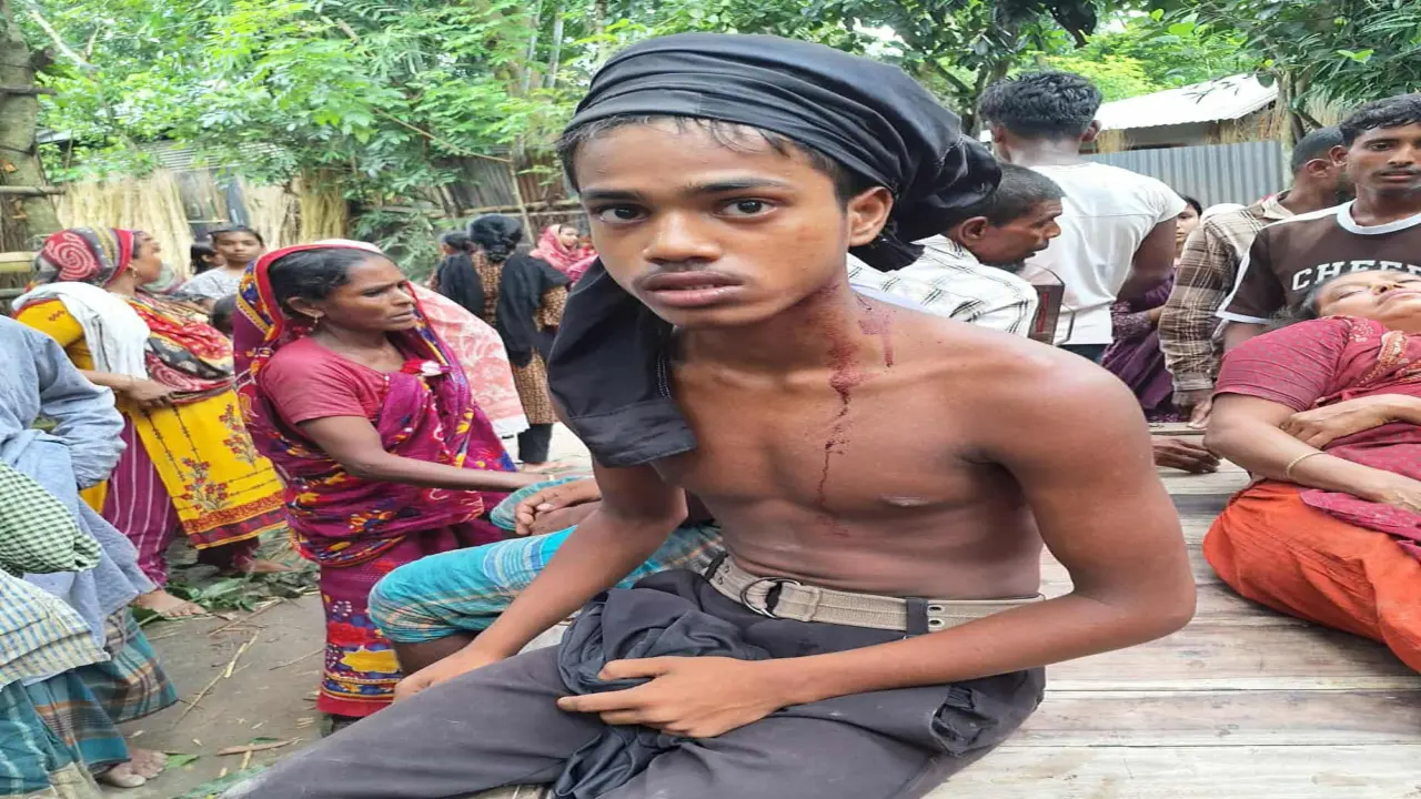 গোপালগঞ্জে বিষঁ দিয়ে জমির ধান পোড়ানোকে কেন্দ্র করে প্রতিপক্ষের হামলায় নারীসহ আহত-১৫