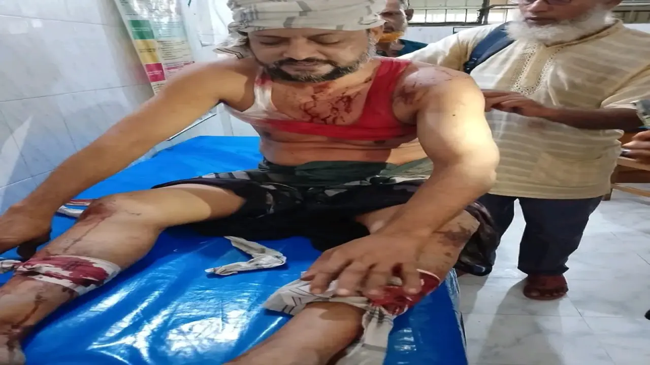 ইন্দুরকানীতে তুচ্ছ ঘটনাকে কেন্দ্র করে সংঘর্ষ, আহত ১