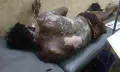 বামনায় বিদ্যুৎস্পৃষ্টে যুবক আহত