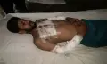 দুমকিতে রাতের আঁধারে গাড়িচালককে কুপিয়ে জখম