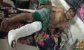 গলাচিপায় তুচ্ছ ঘটনাকে কেন্দ্র করে মারামারি গুরুতর আহত এক